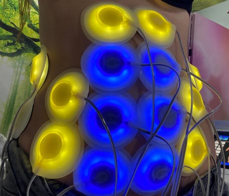 Biostimulare Idealis Beauty Remodelare Corporala si Faciala Salon Craiova