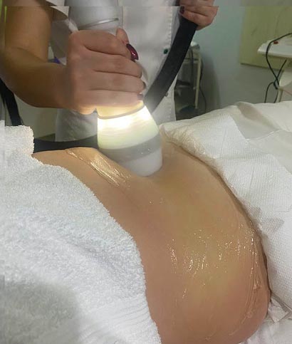 Crioradiofrecventa Idealis Beauty Remodelare Corporala si Faciala Salon Craiova