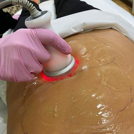 Himfu Idealis Beauty Remodelare Corporala si Faciala Salon Craiova